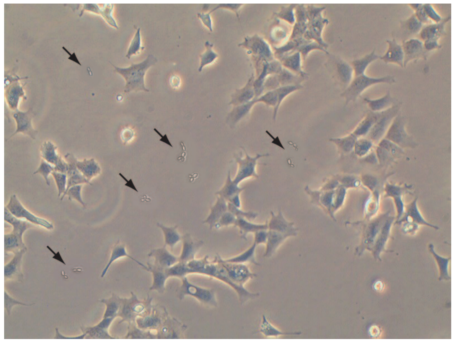 Immunity 专家确定了在COVID-19应对中扩大和改进抗体检测的步骤 - 组学专区 - 生物谷