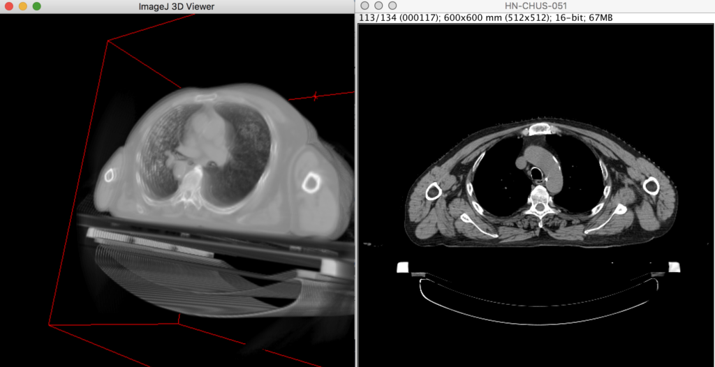 头颈部CT影像数据集-Head-Neck-CT Dataset