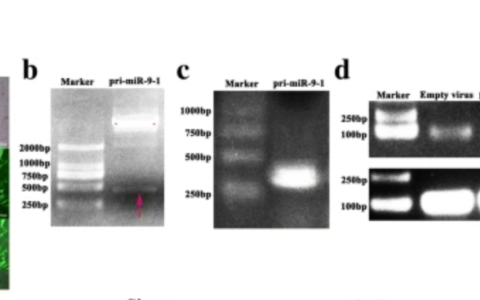 重复用图: MicroRNA-9 modified bone marrow-derived mesenchymal stem cells (BMSCs) repair severe acute pancreatitis (SAP) via inducing angiogenesis in rats
