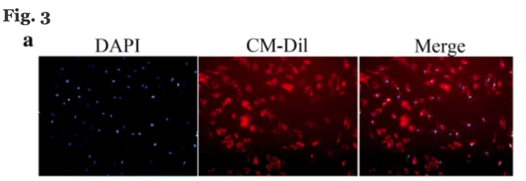 重复用图: MicroRNA-9 modified bone marrow-derived mesenchymal stem cells (BMSCs) repair severe acute pancreatitis (SAP) via inducing angiogenesis in rats