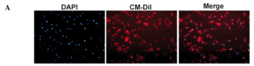 重复用图: MicroRNA-9 modified bone marrow-derived mesenchymal stem cells (BMSCs) repair severe acute pancreatitis (SAP) via inducing angiogenesis in rats