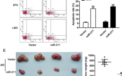 重复用图:MiRNA-211 suppresses cell proliferation, migration and invasion by targeting SPARC in human hepatocellular carcinoma