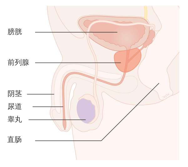 前列腺癌Prostate cancer发病原因和治疗方法